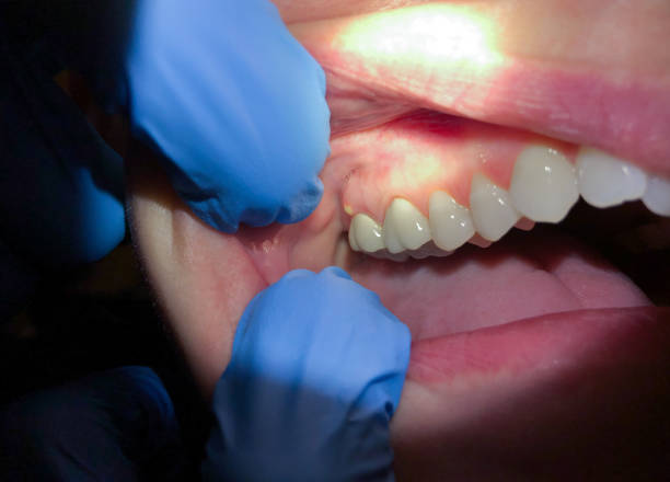 Best Knocked-Out Tooth Emergency  in Estell Manor, NJ