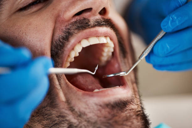 Best Tooth Infection Emergency Dentist  in Estell Manor, NJ